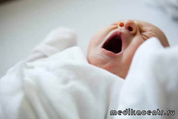 Кровоизлияние в мозг у новорожденных