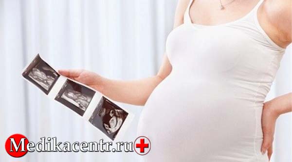 УЗИ на 30 неделе беременности