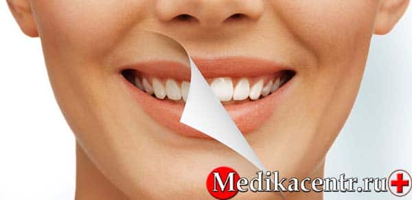 Плюсы и минусы ультразвуковой очистки зубов