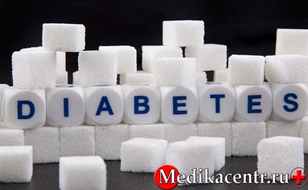 Какие существуют типы диабета