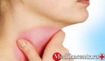 Гипотиреоз - заболевание щитовидной железы
